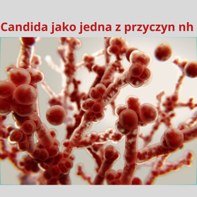 CANDIDA A NIETOLERANCJA HISTAMINY -CZY PRZEROST GRZYBÓW MOŻE NASILAĆ OBJAWY